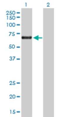 Western Blot: ACD Antibody [H00065057-D01P] - Analysis of ACD expression in transfected 293T cell line by ACD polyclonal antibody.Lane 1: ACD transfected lysate(57.70 KDa).Lane 2: Non-transfected lysate.