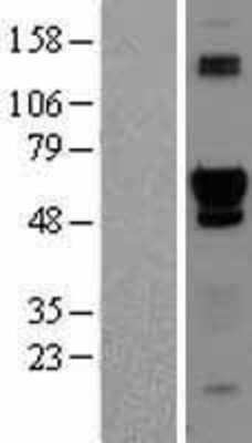 Western Blot: ACD Overexpression Lysate (Adult Normal) [NBL1-07235] Left-Empty vector transfected control cell lysate (HEK293 cell lysate); Right -Over-expression Lysate for ACD.