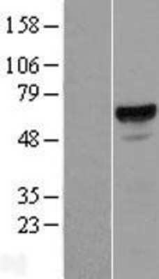 Western Blot: ACD Overexpression Lysate (Adult Normal) [NBL1-07236] Left-Empty vector transfected control cell lysate (HEK293 cell lysate); Right -Over-expression Lysate for ACD.