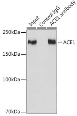 Immunoprecipitation: ACE/CD143 Antibody (1C9J3) [NBP3-15373] - Immunoprecipitation analysis of 600ug extracts of Mouse kidney cells using 3ug ACE/CD143 antibody (NBP3-15373). Western blot was performed from the immunoprecipitate using ACE/CD143 antibody (NBP3-15373) at a dilition of 1:1000.