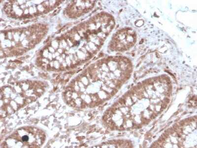 Immunohistochemistry-Paraffin: ACE/CD143 Antibody (ACE/3762) - Azide and BSA Free [NBP3-08557] - Formalin-fixed, paraffin-embedded human colon stained with ACE/CD143 Mouse Monoclonal Antibody (ACE/3762).