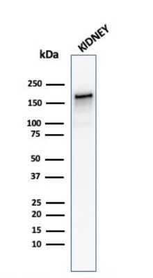 Western Blot: ACE/CD143 Antibody (ACE/3762) - Azide and BSA Free [NBP3-08557] - Western Blot Analysis of human Kidney tissue lysate using ACE/CD143 Mouse Monoclonal Antibody (ACE/3762).