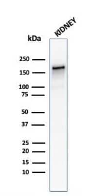 Western Blot: ACE/CD143 Antibody (ACE/3762) [NBP3-07607] - Western Blot Analysis of human Kidney tissue lysate using ACE/CD143 Mouse Monoclonal Antibody (ACE/3762).