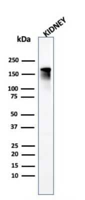 Western Blot: ACE/CD143 Antibody (ACE/3765) - Azide and BSA Free [NBP3-08497] - Western Blot Analysis of human Kidney tissue lysate using ACE/CD143 Mouse Monoclonal Antibody (ACE/3765).