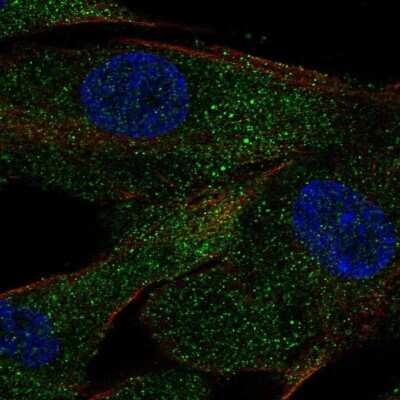 Immunocytochemistry/Immunofluorescence: ACE/CD143 Antibody [NBP2-57207] - Staining of human cell line ASC TERT1 shows localization to vesicles.