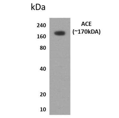 Western Blot: ACE/CD143 Antibody (MM0072-12J16) [NBP2-12007] - Lysates of human lung tissues.