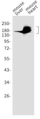 Western Blot: ACE/CD143 Antibody (S01-9E3) [NBP3-19570] - Western blot detection of ACE/CD143 in mouse liver, mouse heart cell lysates using NBP3-19570 (1:1000 diluted). Predicted band size: 151kDa. Observed band size: 180kDa.