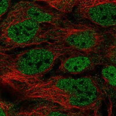 Immunocytochemistry/Immunofluorescence: ACF Antibody [NBP2-33412] - Staining of human cell line CACO-2 shows localization to nucleoplasm. Antibody staining is shown in green.