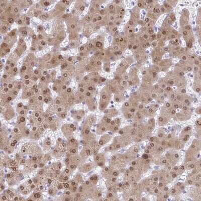 Immunohistochemistry-Paraffin: ACF Antibody [NBP2-33412] - Staining of human liver shows moderate cytoplasmic and nuclear positivity in hepatocytes.