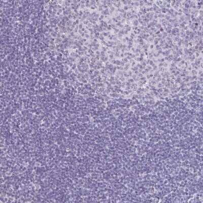 Immunohistochemistry-Paraffin: ACF Antibody [NBP2-33412] - Staining of human tonsil shows no positivity as expected.
