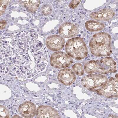 Immunohistochemistry-Paraffin: ACF Antibody [NBP2-33412] - Staining of human kidney shows moderate nuclear positivity in cells in tubules.