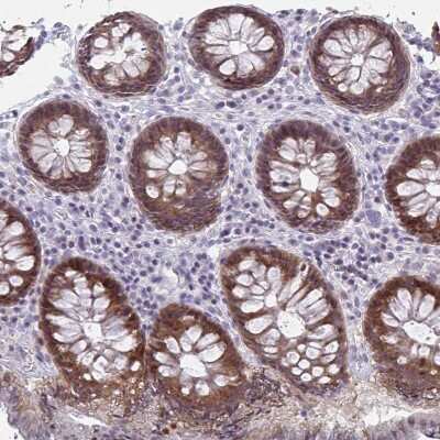 Immunohistochemistry-Paraffin: ACF Antibody [NBP2-33412] - Staining of human colon shows positivity in glandular cells.