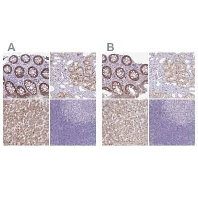 Immunohistochemistry-Paraffin: ACF Antibody [NBP2-33412] - Staining of human colon, kidney, liver and tonsil using Anti-A1CF antibody NBP2-33412 (A) shows similar protein distribution across tissues to independent antibody NBP1-90271 (B).