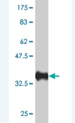 Western Blot: ACF1 Antibody (1F6) [H00011177-M01] - Detection against Immunogen (36.74 KDa) .