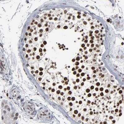 Immunohistochemistry: ACF1 Antibody [NBP1-90270] - Staining of human testis shows strong nuclear positivity in cells of seminiferus ducts.