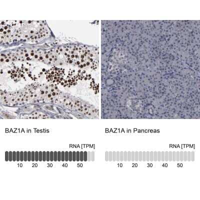 Immunohistochemistry-Paraffin: ACF1 Antibody [NBP1-90270] - Analysis in human testis and pancreas tissues using NBP1-90270 antibody. Corresponding ACF1 RNA-seq data are presented for the same tissues.