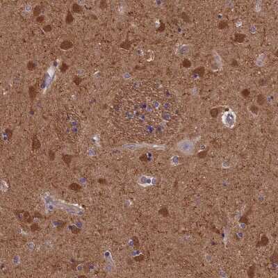 Immunohistochemistry-Paraffin: ACK1 Antibody [NBP1-90822] - Staining of human lateral ventricle shows strong nuclear and cytoplasmic positivity in neuronal cells.