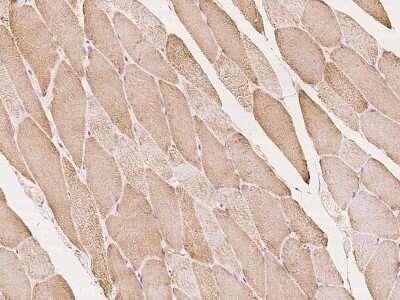 Immunohistochemistry-Paraffin: ACK1 Antibody [NBP2-97358] - Immunochemical staining of human ACK1 in human kidney with rabbit polyclonal antibody at 1:100 dilution, formalin-fixed paraffin embedded sections.