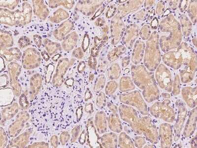 Immunohistochemistry-Paraffin: ACK1 Antibody [NBP2-97358] - Immunochemical staining of human ACK1 in human skeletal muscle with rabbit polyclonal antibody at 1:100 dilution, formalin-fixed paraffin embedded sections.
