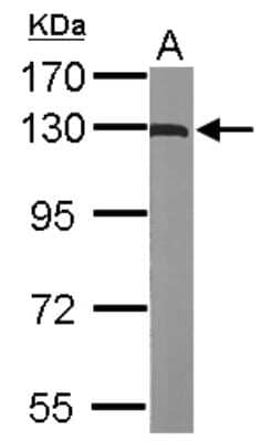 Western Blot: ACK1 Antibody [NBP1-32311] - Sample (50 ug of whole cell lysate) A: Mouse brain 7. 5% SDS PAGE; antibody diluted at 1:1000.