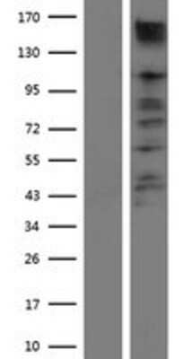 Western Blot: ACK1 Overexpression Lysate (Adult Normal) [NBP2-10443] Left-Empty vector transfected control cell lysate (HEK293 cell lysate); Right -Over-expression Lysate for ACK1.