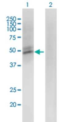 Western Blot: ACMSD Antibody (3A9) [H00130013-M01] - Analysis of ACMSD expression in transfected 293T cell line by ACMSD monoclonal antibody (M01), clone 3A9.Lane 1: ACMSD transfected lysate (Predicted MW: 31.2 KDa).Lane 2: Non-transfected lysate.