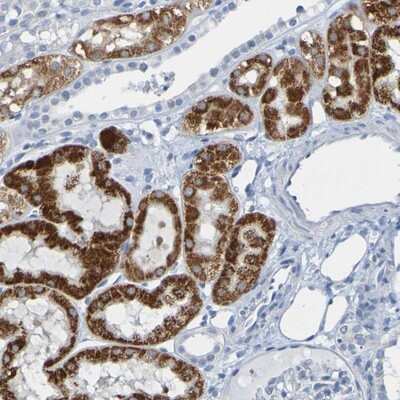 Immunohistochemistry-Paraffin: ACMSD Antibody [NBP1-86480] - Staining of human kidney shows strong cytoplasmic positivity in cells in tubules.