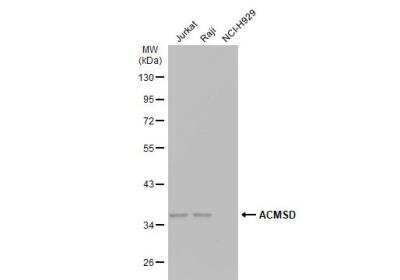 Western Blot: ACMSD Antibody [NBP1-33499] - Various whole cell extracts (30 ug) were separated by 10% SDS-PAGE, and the membrane was blotted with ACMSD antibody [N2C3] diluted at 1:1000. The HRP-conjugated anti-rabbit IgG antibody (NBP2-19301) was used to detect the primary antibody.