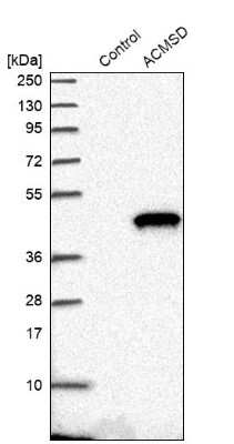 Western Blot: ACMSD Antibody [NBP1-86480] - Analysis in control (vector only transfected HEK293T lysate) and ACMSD over-expression lysate (Co-expressed with a C-terminal myc-DDK tag (3.1 kDa) in mammalian HEK293T cells).