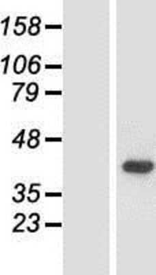 Western Blot ACMSD Overexpression Lysate