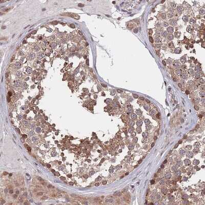 Immunohistochemistry-Paraffin ACN9 Antibody