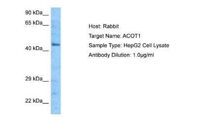 Western Blot: ACOT1 Antibody [NBP2-82573] - Host: Rabbit. Target Name: ACOT1. Sample Tissue: Human HepG2 Whole Cell lysates. Antibody Dilution: 1ug/ml