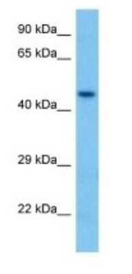Western Blot: ACOT1 Antibody [NBP3-10843] - Western blot analysis of ACOT1 in Mouse Pancreas lysates. Antibody dilution at 1ug/ml