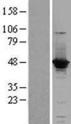 Western Blot: ACOT1 Overexpression Lysate (Adult Normal) [NBL1-07245] Left-Empty vector transfected control cell lysate (HEK293 cell lysate); Right -Over-expression Lysate for ACOT1.