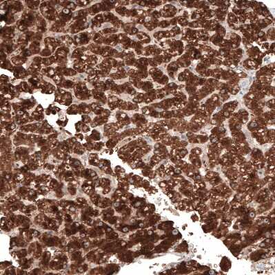 Immunohistochemistry-Paraffin: ACOT4 Antibody [NBP1-83539] - Staining of human liver shows strong granular cytoplasmic positivity in hepatocytes.