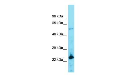 Western Blot: ACOT4 Antibody [NBP2-82575] - Host: Rabbit. Target Name: ACOT4. Sample Type: Lymph Node Tumor lysates. Antibody Dilution: 1.0ug/ml