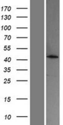 Western Blot: ACOT4 Overexpression Lysate (Adult Normal) [NBP2-05401] Left-Empty vector transfected control cell lysate (HEK293 cell lysate); Right -Over-expression Lysate for ACOT4.