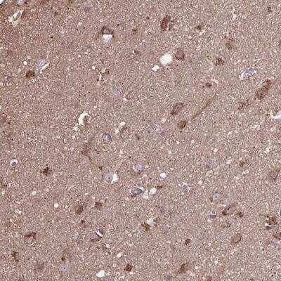 Immunohistochemistry-Paraffin: ACOT6 Antibody [NBP2-31708] - Staining of human cerebral cortex shows cytoplasmic and nucleolar positivity in neuronal cells.