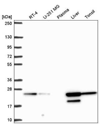 Western Blot: ACOT6 Antibody [NBP2-31708] - Analysis in human cell line RT-4, human cell line U-251 MG, human plasma, human liver tissue and human tonsil tissue.