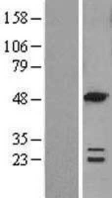 Western Blot: ACOT6 Overexpression Lysate (Adult Normal) [NBL1-07248] Left-Empty vector transfected control cell lysate (HEK293 cell lysate); Right -Over-expression Lysate for ACOT6.