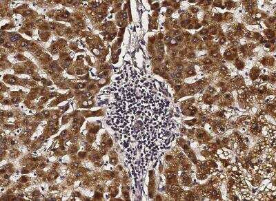 Immunohistochemistry-Paraffin: ACOX1 Antibody (003) [NBP2-89864] - Staining of human ACOX1 in human liver with rabbit monoclonal antibody (1:200).