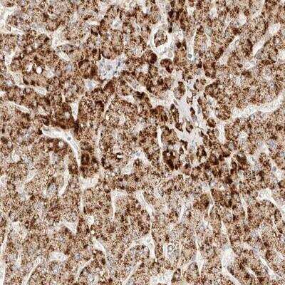 Immunohistochemistry-Paraffin: ACOX1 Antibody [NBP1-80949] - Staining of human liver shows strong cytoplasmic positivity with a granular pattern in hepatocytes.