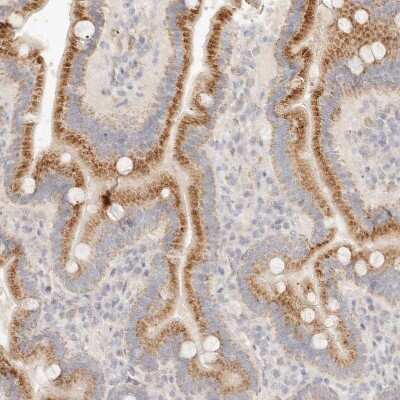 Immunohistochemistry-Paraffin: ACOX1 Antibody [NBP1-80949] - Staining of human duodenum shows strong  granular cytoplasmic positivity in glandular cells.