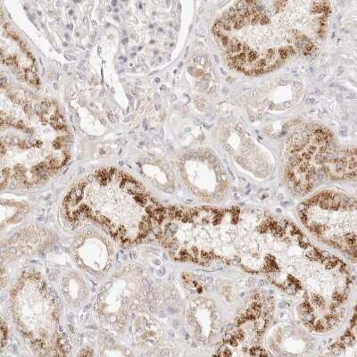 Immunohistochemistry-Paraffin: ACOX1 Antibody [NBP1-80949] - Staining of human kidney shows moderate granular cytoplasmic positivity in cells in tubules.