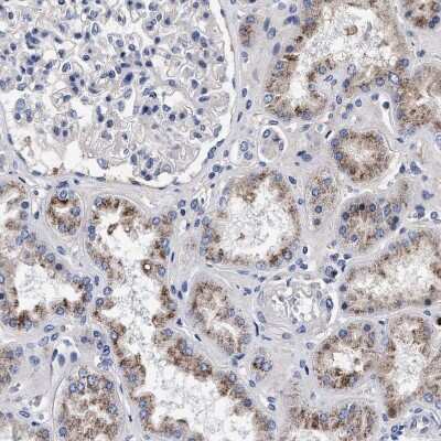 Immunohistochemistry-Paraffin: ACOX1 Antibody [NBP1-80950] - Staining of human kidney shows moderate granular cytoplasmic positivity in cells in tubules.