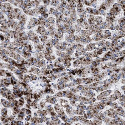 Immunohistochemistry-Paraffin: ACOX1 Antibody [NBP1-80950] - Staining of human liver shows strong granular cytoplasmic positivity in hepatocytes.