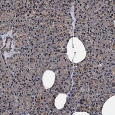 Immunohistochemistry-Paraffin: ACOX1 Antibody [NBP1-80951] - Staining of human pancreas shows weak cytoplasmic positivity in exocrine glandular cells.