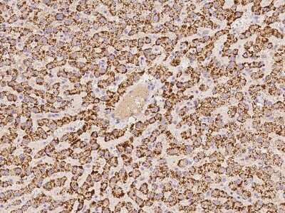 Immunohistochemistry-Paraffin: ACOX1 Antibody [NBP2-97895] - Immunochemical staining of human ACOX1 in human liver with rabbit polyclonal antibody at 1:100 dilution, formalin-fixed paraffin embedded sections.