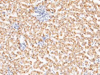 Immunohistochemistry-Paraffin: ACOX1 Antibody [NBP2-99761] - Immunochemical staining of human ACOX1 in human cirrhosis with rabbit polyclonal antibody (1:1000, formalin-fixed paraffin embedded sections). Positive staining was localized to hepatocyte.