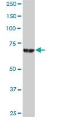 Western Blot: ACOX2 Antibody [H00008309-B01P] - Analysis of ACOX2 expression in human liver.